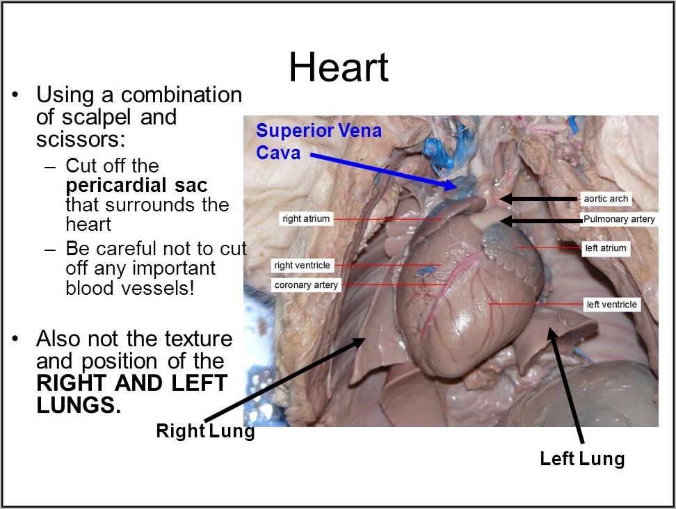 Fetal Pig Heart Diagram