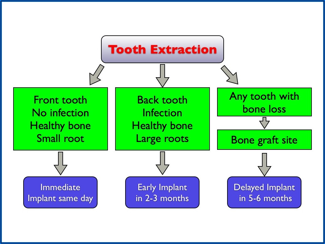 Tooth Extraction And Implant Timeline Uk