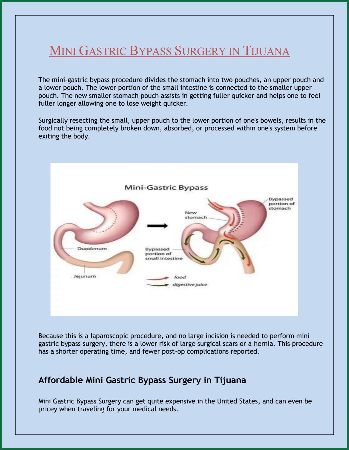 Laparoscopic Gastric Bypass Surgery Recovery Time