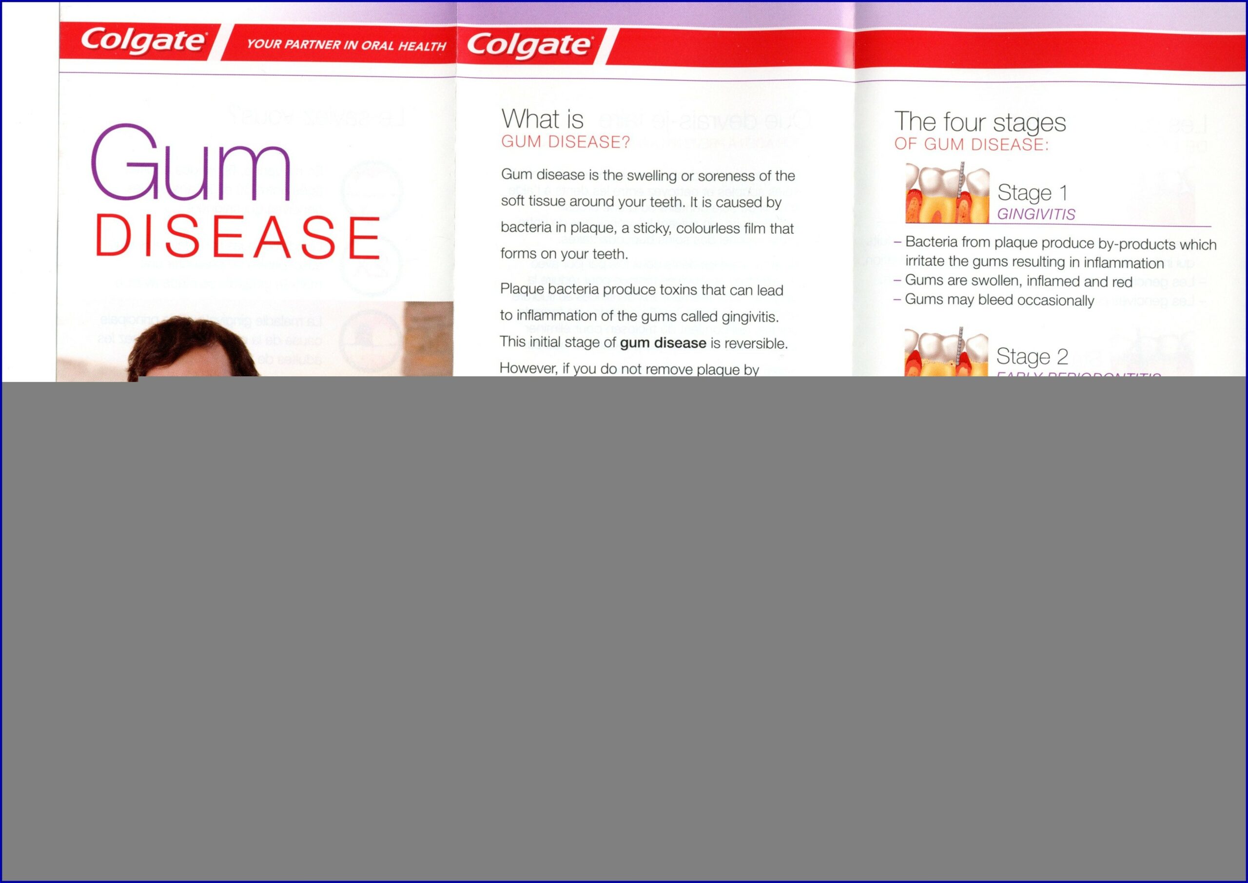 Colgate Gum Disease Brochure